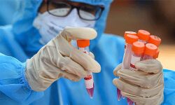 സമൂഹവ്യാപനം തടയാന്‍ കോഴിക്കോട് മെഗാ കൊവിഡ് പരിശോധന: 17,850 പേര്‍ പരിശോധനക്ക് വിധേയരായി