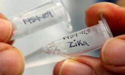 സിക്ക ബാധിച്ച രോഗിയുടെ കുടുംബാംഗങ്ങളുടെ സാംപിളുകള് പരിശോധനയ്ക്ക് അയച്ചു സിക്ക ബാധിച്ച രോഗിയുടെ കുടുംബാംഗങ്ങളുടെ സാംപിളുകള് പരിശോധനയ്ക്ക് അയച്ചു