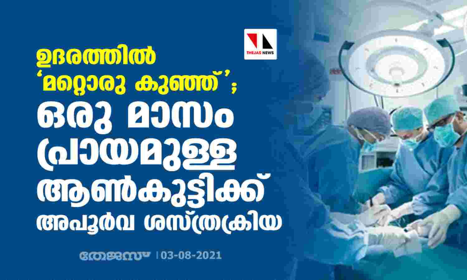 ഉദരത്തില് മറ്റൊരു കുഞ്ഞ്; ഒരു മാസം പ്രായമുള്ള ആണ്കുട്ടിക്ക് അപൂര്വ ശസ്ത്രക്രിയ ഉദരത്തില് മറ്റൊരു കുഞ്ഞ്; ഒരു മാസം പ്രായമുള്ള ആണ്കുട്ടിക്ക് അപൂര്വ ശസ്ത്രക്രിയ