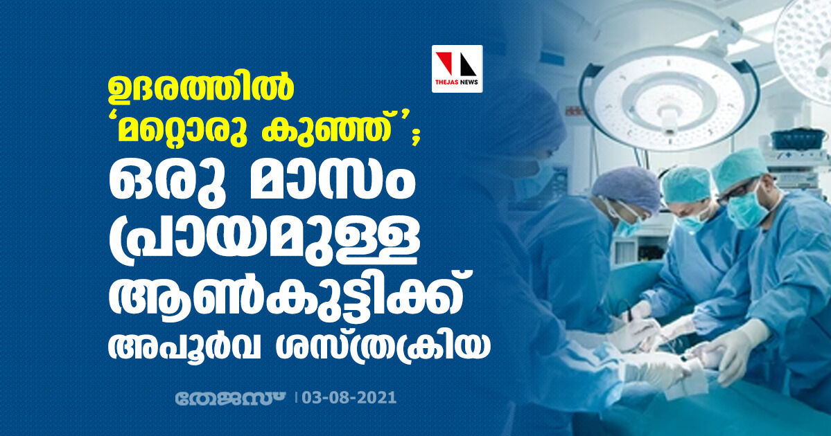 ഉദരത്തില്‍ മറ്റൊരു കുഞ്ഞ്; ഒരു മാസം പ്രായമുള്ള ആണ്‍കുട്ടിക്ക് അപൂര്‍വ ശസ്ത്രക്രിയ