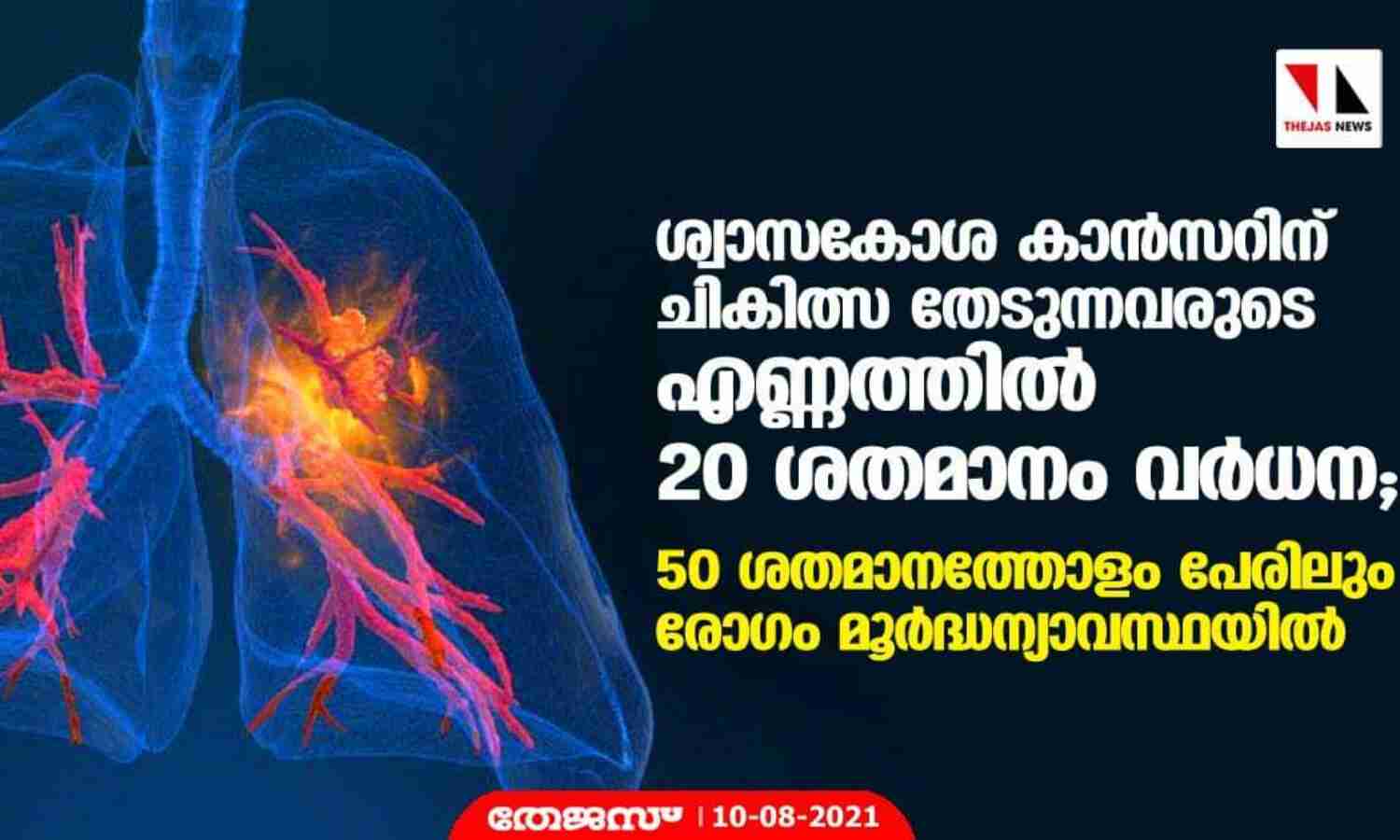 ശ്വാസകോശ കാന്സറിന് ചികിത്സ തേടുന്നവരുടെ എണ്ണത്തില് 20 ശതമാനം വര്ധന ; 50 ശതമാനത്തോളം പേരിലും രോഗം മൂര്ധന്യാവസ്ഥയില് ശ്വാസകോശ കാന്സറിന് ചികിത്സ തേടുന്നവരുടെ എണ്ണത്തില് 20 ശതമാനം വര്ധന ; 50 ശതമാനത്തോളം പേരിലും രോഗം മൂര്ധന്യാവസ്ഥയില്