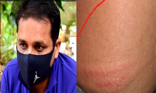 കഴക്കൂട്ടത്ത് വീടിന് സമീപം നിന്ന യുവാവിന് പോലിസ് മര്‍ദ്ദനം; കഴക്കൂട്ടം എസ്‌ഐ വിഷ്ണുവിനെ സസ്‌പെന്റ് ചെയ്തു