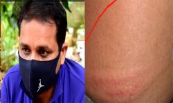 കഴക്കൂട്ടത്ത് വീടിന് സമീപം നിന്ന യുവാവിന് പോലിസ് മര്‍ദ്ദനം; കഴക്കൂട്ടം എസ്‌ഐ വിഷ്ണുവിനെ സസ്‌പെന്റ് ചെയ്തു