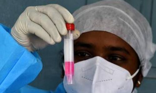 കോഴിക്കോട് ജില്ലയില്‍ 2440 പേര്‍ക്ക് കൊവിഡ്