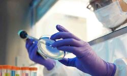 നിപ പരിശോധനയ്ക്ക് കോഴിക്കോട് മെഡി. കോളജില്‍ പ്രത്യേക ലാബ്, ഇന്ന് മുതല്‍ പ്രവര്‍ത്തനം തുടങ്ങും