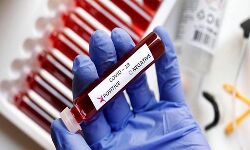 പാലക്കാട് ജില്ലയില്‍ ഇന്ന് 1644 പേര്‍ക്ക് കൊവിഡ്; 1961 പേര്‍ക്ക് രോഗമുക്തി