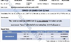 പരിശോധന നടത്താതെ ആര്‍ടിപിസിആര്‍ നെഗറ്റിവ് സര്‍ട്ടിഫിക്കറ്റ്; മഞ്ചേരി മെഡിക്കല്‍ കോളെജിനു സമീപത്തെ ലാബ് പൂട്ടാന്‍ നോട്ടീസ്