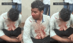 തൊപ്പി ധരിച്ചതിന്റെ പേരില്‍ രണ്ട് മുസ് ലിം വിദ്യാര്‍ഥികള്‍ക്ക് ക്രൂര മര്‍ദനം