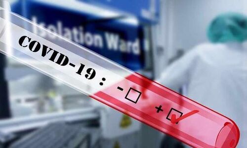 പാലക്കാട് ജില്ലയില്‍ ഇന്ന് 359 പേര്‍ക്ക് കൊവിഡ്; 582 പേര്‍ക്ക് രോഗമുക്തി