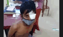 കളി തടസ്സപ്പെടുത്തിയത് ചോദ്യം ചെയ്ത 15 കാരന് അയല്‍വാസിയുടെ ക്രൂര മര്‍ദ്ദനം; കണ്ണിന് പരിക്കേറ്റു