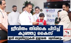 ജീവിതം തിരികെ പിടിച്ച് കുഞ്ഞ് കൈസ്; ഇനി ബുദ്ധിമുട്ടുകള്‍ ഇല്ലാതെ ശ്വസിക്കും