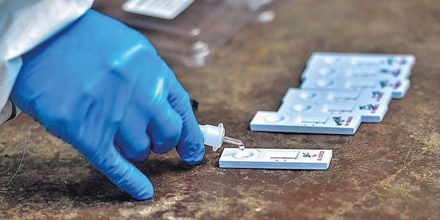കരിപ്പൂര് വിമാനത്താവളത്തിലെ ആര്ടിപിസിആര് നിരക്ക് കുറച്ചു കരിപ്പൂര് വിമാനത്താവളത്തിലെ ആര്ടിപിസിആര് നിരക്ക് കുറച്ചു