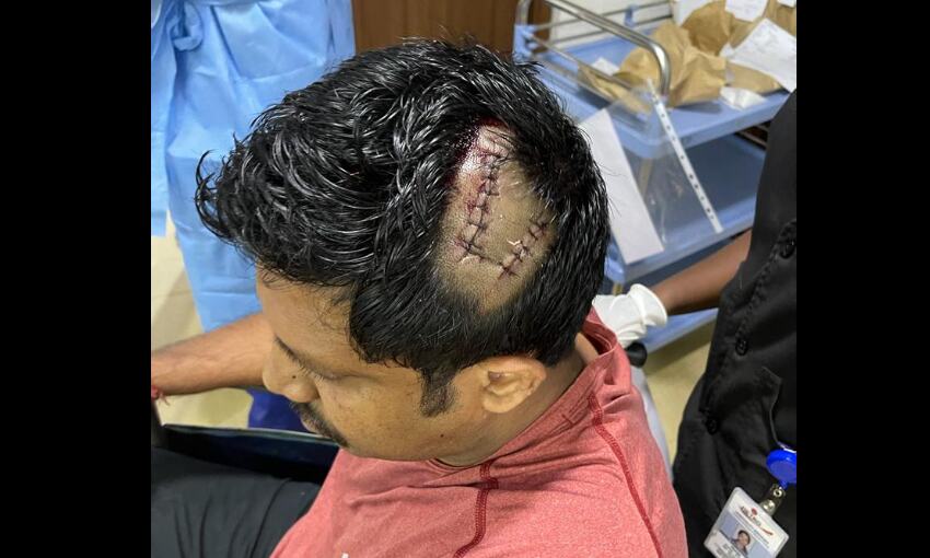 പ്രണയ വിവാഹത്തെ പിന്തുണച്ചതിന് സിപിഐ പ്രവര്ത്തകനു നേരെ ആക്രമണം പ്രണയ വിവാഹത്തെ പിന്തുണച്ചതിന് സിപിഐ പ്രവര്ത്തകനു നേരെ ആക്രമണം