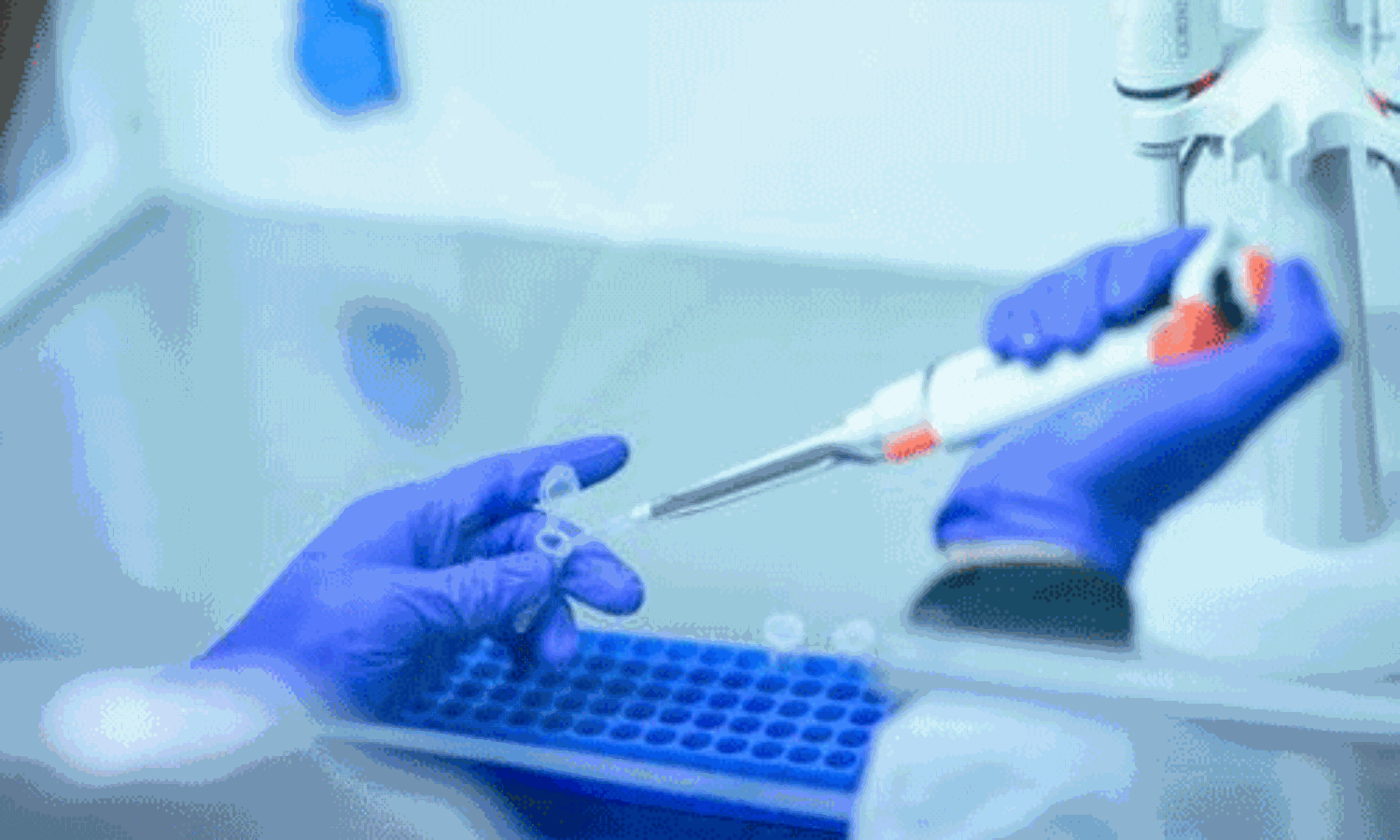 കോഴിക്കോട് ജില്ലയില് 580 പേര്ക്ക് കൊവിഡ്; ടിപിആര് 9.86 ശതമാനം കോഴിക്കോട് ജില്ലയില് 580 പേര്ക്ക് കൊവിഡ്; ടിപിആര് 9.86 ശതമാനം