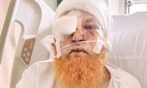 മുംബൈയില്‍ ദുര്‍മന്ത്രവാദം ആരോപിച്ച് മുസ്‌ലിം പണ്ഡിതന് ക്രൂരമര്‍ദ്ദനം