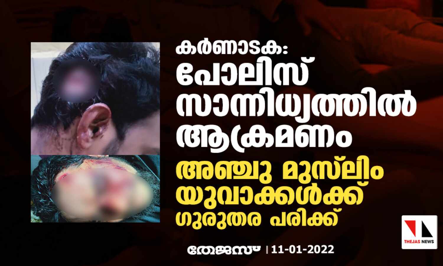 കര്‍ണാടക: പോലിസ് സാന്നിധ്യത്തില്‍ ആക്രമണം; അഞ്ചു മുസ്‌ലിം യുവാക്കള്‍ക്ക് ഗുരുതര പരിക്ക്