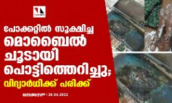 പോക്കറ്റിൽ സൂക്ഷിച്ച മൊബൈൽ ചൂടായി പൊട്ടിത്തെറിച്ചു; വിദ്യാർഥിക്ക് പരിക്ക്