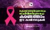 ലക്ഷണങ്ങളിലൂടെയും സ്‌ക്രീനിങ്ങിലൂടെയും കണ്ടെത്താം ഈ കാന്‍സറുകള്‍