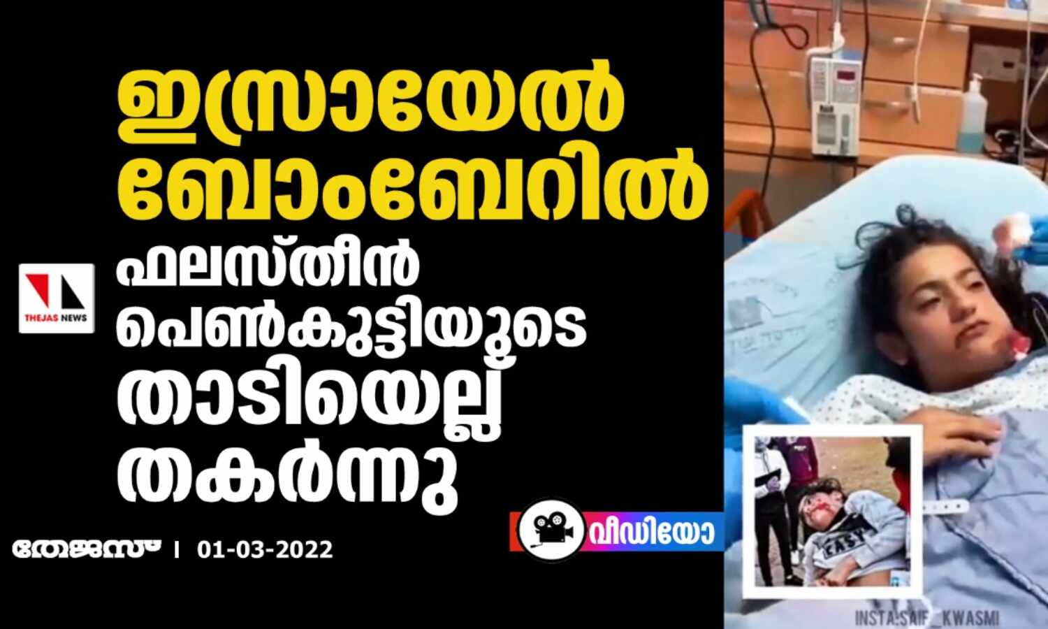 ഇസ്രായേല് ബോംബേറില് ഫലസ്തീന് പെണ്കുട്ടിയുടെ താടിയെല്ല് തകര്ന്നു (വീഡിയോ) ഇസ്രായേല് ബോംബേറില് ഫലസ്തീന് പെണ്കുട്ടിയുടെ താടിയെല്ല് തകര്ന്നു (വീഡിയോ)