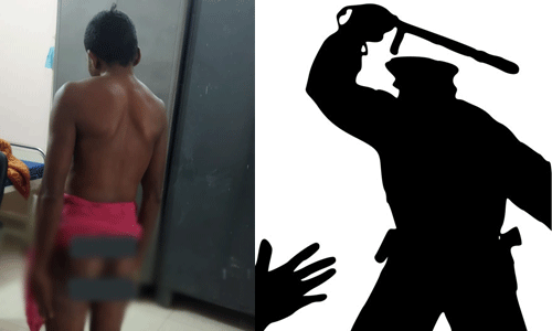 മാവോവാദി ബന്ധം ആരോപിച്ച് ആദിവാസി യുവാവിനെ ക്രൂരമായി മര്ദിച്ചു മാവോവാദി ബന്ധം ആരോപിച്ച് ആദിവാസി യുവാവിനെ ക്രൂരമായി മര്ദിച്ചു