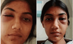 യുവതിയെ മര്‍ദ്ദിച്ച് ഒളിവില്‍ പോയ ഭര്‍തൃമാതാവിന്റെ സുഹൃത്ത് അറസ്റ്റില്‍