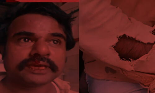 മലപ്പുറത്ത് രോഗിയുമായി പോയ ഓട്ടോറിക്ഷാ ഡ്രൈവര്ക്ക് സമരാനുകൂലികളുടെ മര്ദനം മലപ്പുറത്ത് രോഗിയുമായി പോയ ഓട്ടോറിക്ഷാ ഡ്രൈവര്ക്ക് സമരാനുകൂലികളുടെ മര്ദനം