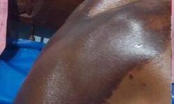 പിതാവിനെതിരേ മകന്റെ ആസിഡാക്രമണം; പിതാവ് മരിച്ചു പിതാവിനെതിരേ മകന്റെ ആസിഡാക്രമണം; പിതാവ് മരിച്ചു