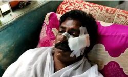 തിരുവനന്തപുരത്ത് സിഐടിയു പ്രവര്‍ത്തകന് വെട്ടേറ്റു