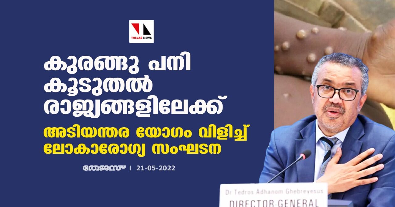 കുരങ്ങു പനി കൂടുതല്‍ രാജ്യങ്ങളിലേക്ക്;അടിയന്തര യോഗം വിളിച്ച് ലോകാരോഗ്യ സംഘടന