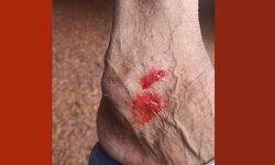 ചാലിയാറില് നീര്നായ ആക്രമണം; കുളിക്കാനിറങ്ങിയ രണ്ടുപേര്ക്ക് കടിയേറ്റു ചാലിയാറില് നീര്നായ ആക്രമണം; കുളിക്കാനിറങ്ങിയ രണ്ടുപേര്ക്ക് കടിയേറ്റു