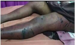 അട്ടപ്പാടിയില്‍ യുവാവ് അടിയേറ്റ് മരിച്ച സംഭവം;ചികില്‍സയിലായിരുന്ന സുഹൃത്തും മരിച്ചു