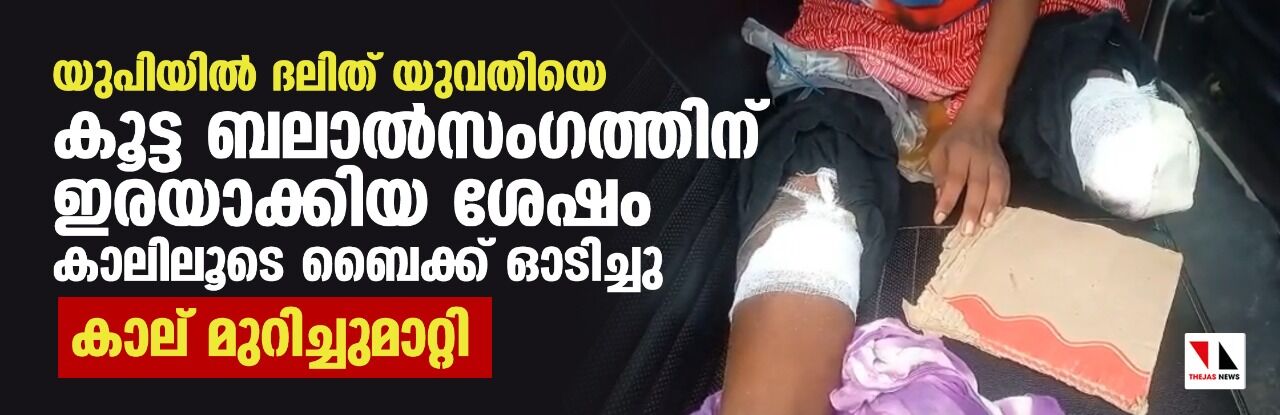 യുപിയില്‍ ദലിത് യുവതിയെ കൂട്ട ബലാല്‍സംഗത്തിന് ഇരയാക്കിയ ശേഷം കാലിലൂടെ ബൈക്ക് ഓടിച്ചു; കാല് മുറിച്ചുമാറ്റി