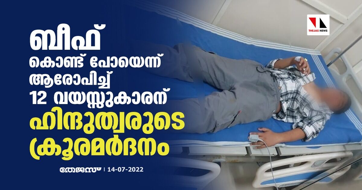 ബീഫ് കൊണ്ട് പോയെന്ന് ആരോപിച്ച് 12 വയസ്സുകാരന് ഹിന്ദുത്വരുടെ ക്രൂരമര്‍ദനം