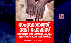 സംസ്ഥാനത്ത് മങ്കി പോക്സ്; വിദേശത്ത് നിന്ന് എത്തിയ കൊല്ലം സ്വദേശിക്ക് രോഗം സ്ഥിരീകരിച്ചു സംസ്ഥാനത്ത് മങ്കി പോക്സ്; വിദേശത്ത് നിന്ന് എത്തിയ കൊല്ലം സ്വദേശിക്ക് രോഗം സ്ഥിരീകരിച്ചു