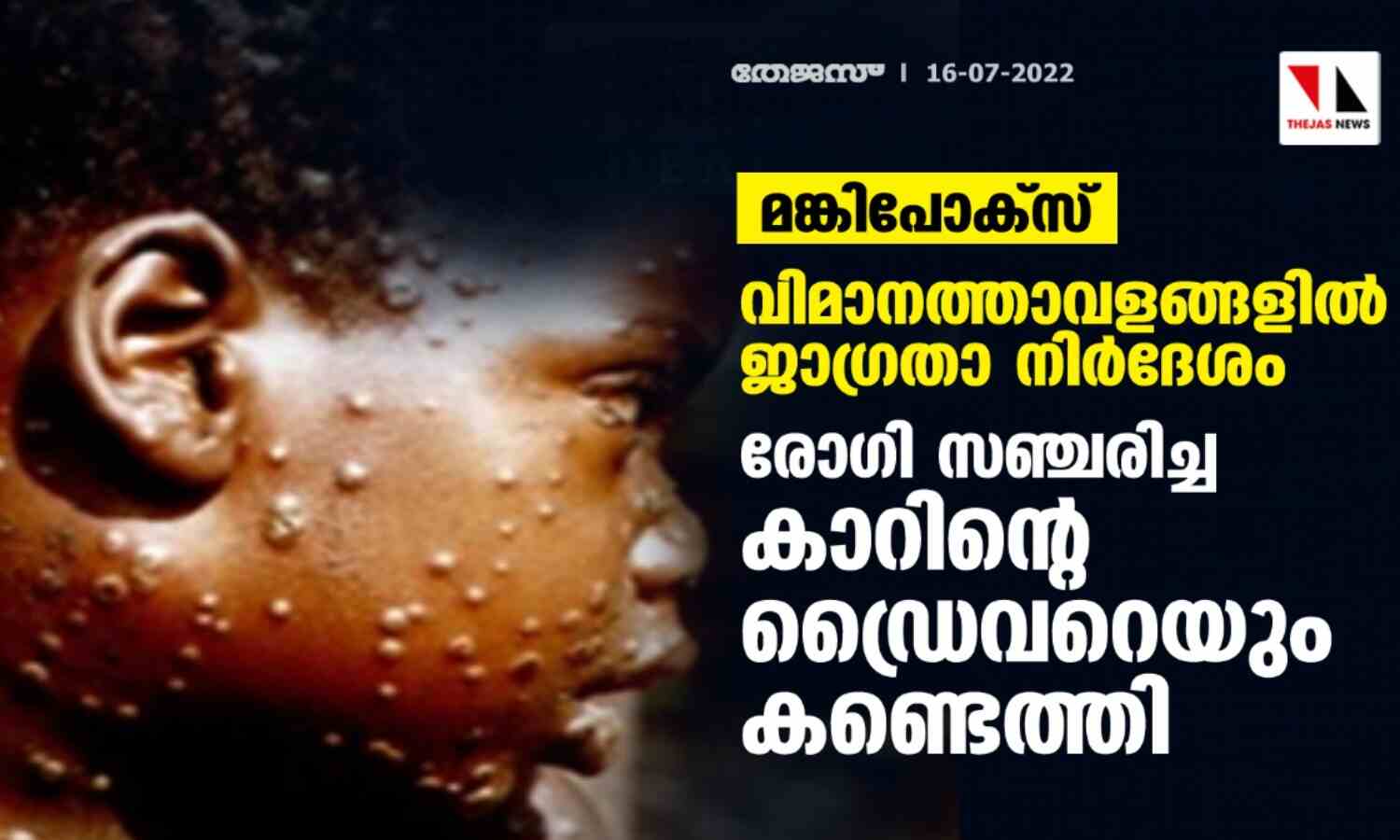 മങ്കിപോക്സ്: വിമാനത്താവളങ്ങളില് ജാഗ്രതാ നിര്ദേശം; രോഗി സഞ്ചരിച്ച കാറിന്റെ ഡ്രൈവറെയും കണ്ടെത്തി മങ്കിപോക്സ്: വിമാനത്താവളങ്ങളില് ജാഗ്രതാ നിര്ദേശം; രോഗി സഞ്ചരിച്ച കാറിന്റെ ഡ്രൈവറെയും കണ്ടെത്തി