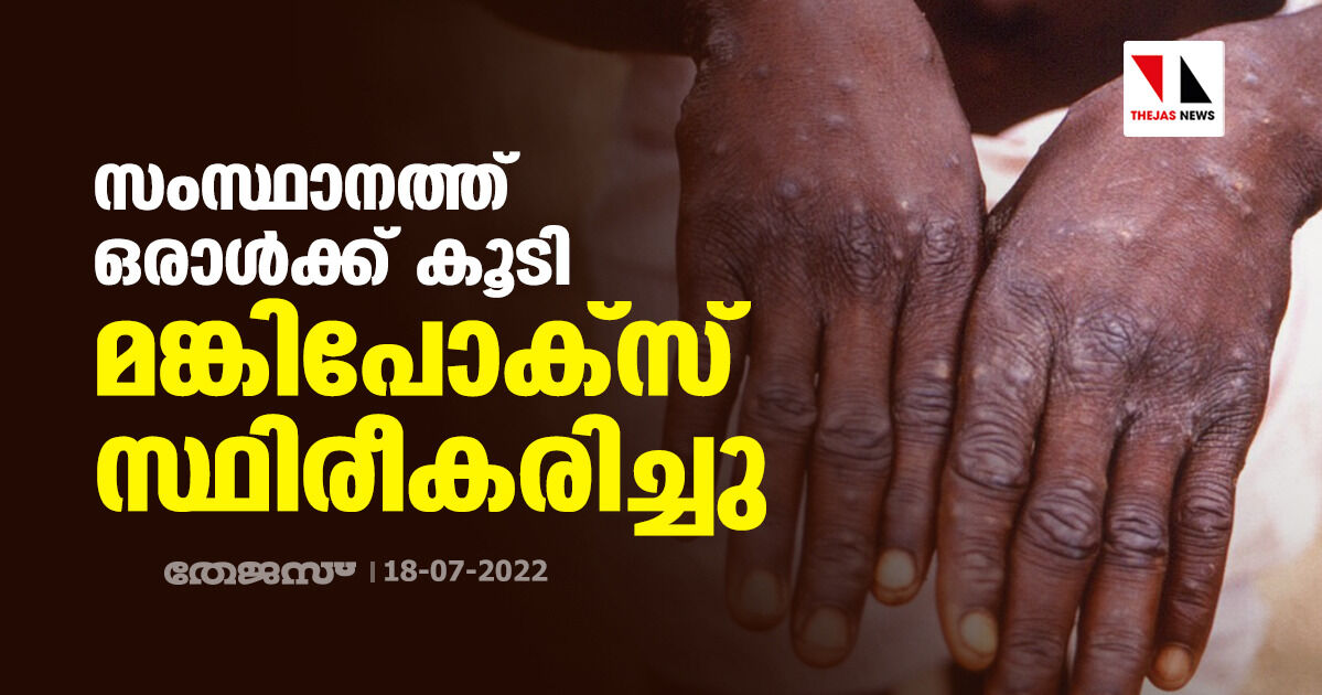 സംസ്ഥാനത്ത് ഒരാള്ക്ക് കൂടി മങ്കിപോക്സ് സ്ഥിരീകരിച്ചു സംസ്ഥാനത്ത് ഒരാള്ക്ക് കൂടി മങ്കിപോക്സ് സ്ഥിരീകരിച്ചു