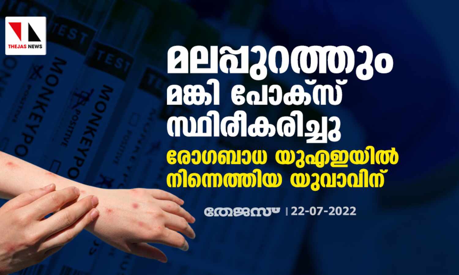 മലപ്പുറത്തും മങ്കി പോക്സ് സ്ഥിരീകരിച്ചു; രോഗബാധ യുഎഇയില് നിന്നെത്തിയ യുവാവിന് മലപ്പുറത്തും മങ്കി പോക്സ് സ്ഥിരീകരിച്ചു; രോഗബാധ യുഎഇയില് നിന്നെത്തിയ യുവാവിന്
