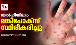 ഡല്‍ഹിയിലും മങ്കിപോക്‌സ് സ്ഥിരീകരിച്ചു