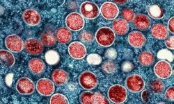 เดฎเดเตเดเดฟเดชเตเดเตเดธเต: เดเดฆเตเดฏ เดฐเตเดเดฟ เดฐเตเดเดฎเตเดเตเดคเดฟ เดจเตเดเดฟ เดฎเดเตเดเดฟเดชเตเดเตเดธเต: เดเดฆเตเดฏ เดฐเตเดเดฟ เดฐเตเดเดฎเตเดเตเดคเดฟ เดจเตเดเดฟ