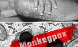 เดเดจเตเดงเตเดฐเดชเตเดฐเดฆเตเดถเดฟเดฒเตโ เดฎเดเตเดเดฟเดชเตเดเตโเดธเต เดฐเตเดเดฒเดเตเดทเดฃเดเตเดเดณเตเดฎเดพเดฏเดฟ 8 เดตเดฏเดธเตเดธเตเดเดพเดฐเดจเตโ เดเดจเตเดงเตเดฐเดชเตเดฐเดฆเตเดถเดฟเดฒเตโ เดฎเดเตเดเดฟเดชเตเดเตโเดธเต เดฐเตเดเดฒเดเตเดทเดฃเดเตเดเดณเตเดฎเดพเดฏเดฟ 8 เดตเดฏเดธเตเดธเตเดเดพเดฐเดจเตโ