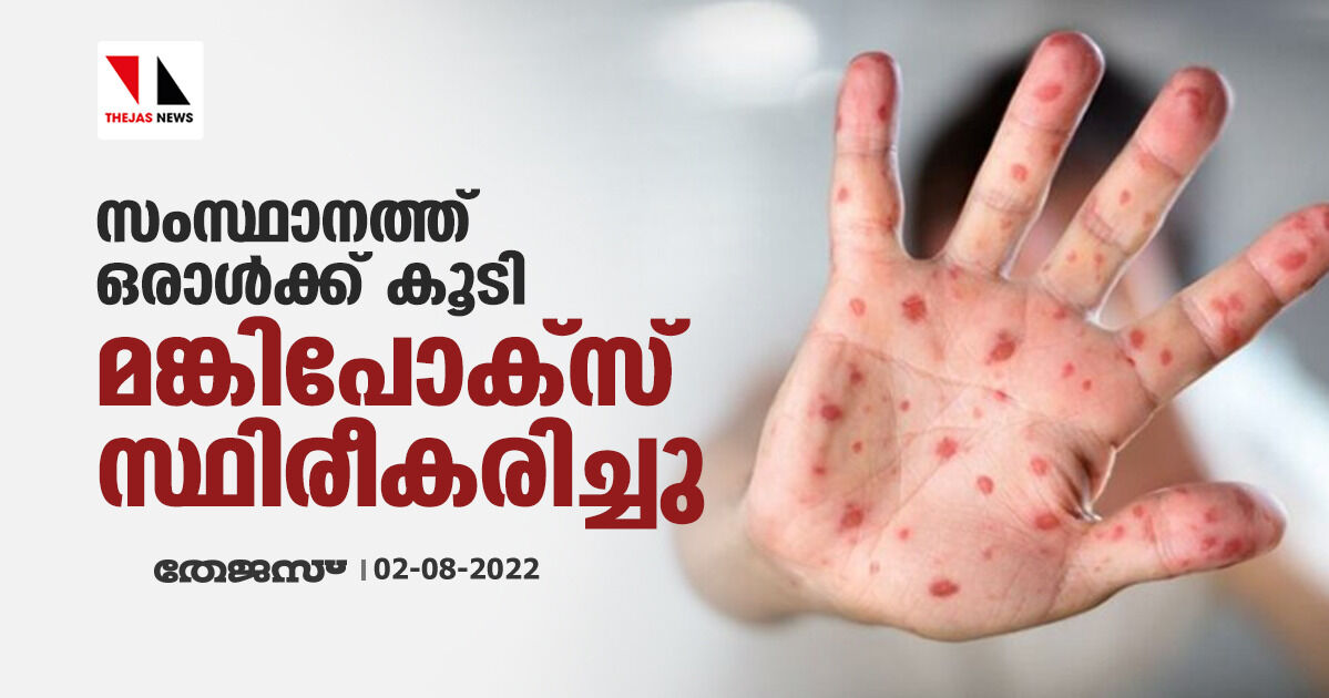 സംസ്ഥാനത്ത് ഒരാള്‍ക്ക് കൂടി മങ്കിപോക്‌സ് സ്ഥിരീകരിച്ചു