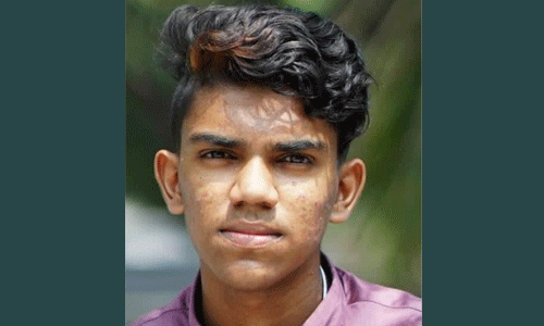 ബൈക്കപകടത്തില് പരുക്കേറ്റ വിദ്യാര്ഥി മരിച്ചു ബൈക്കപകടത്തില് പരുക്കേറ്റ വിദ്യാര്ഥി മരിച്ചു