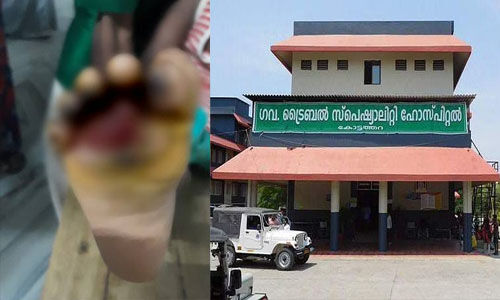 ആദിവാസി ബാലന്റെ കാല് സ്റ്റൗവില് വച്ച് പൊള്ളിച്ചു;അമ്മയും രണ്ടാനച്ചനും അറസ്റ്റില് ആദിവാസി ബാലന്റെ കാല് സ്റ്റൗവില് വച്ച് പൊള്ളിച്ചു;അമ്മയും രണ്ടാനച്ചനും അറസ്റ്റില്