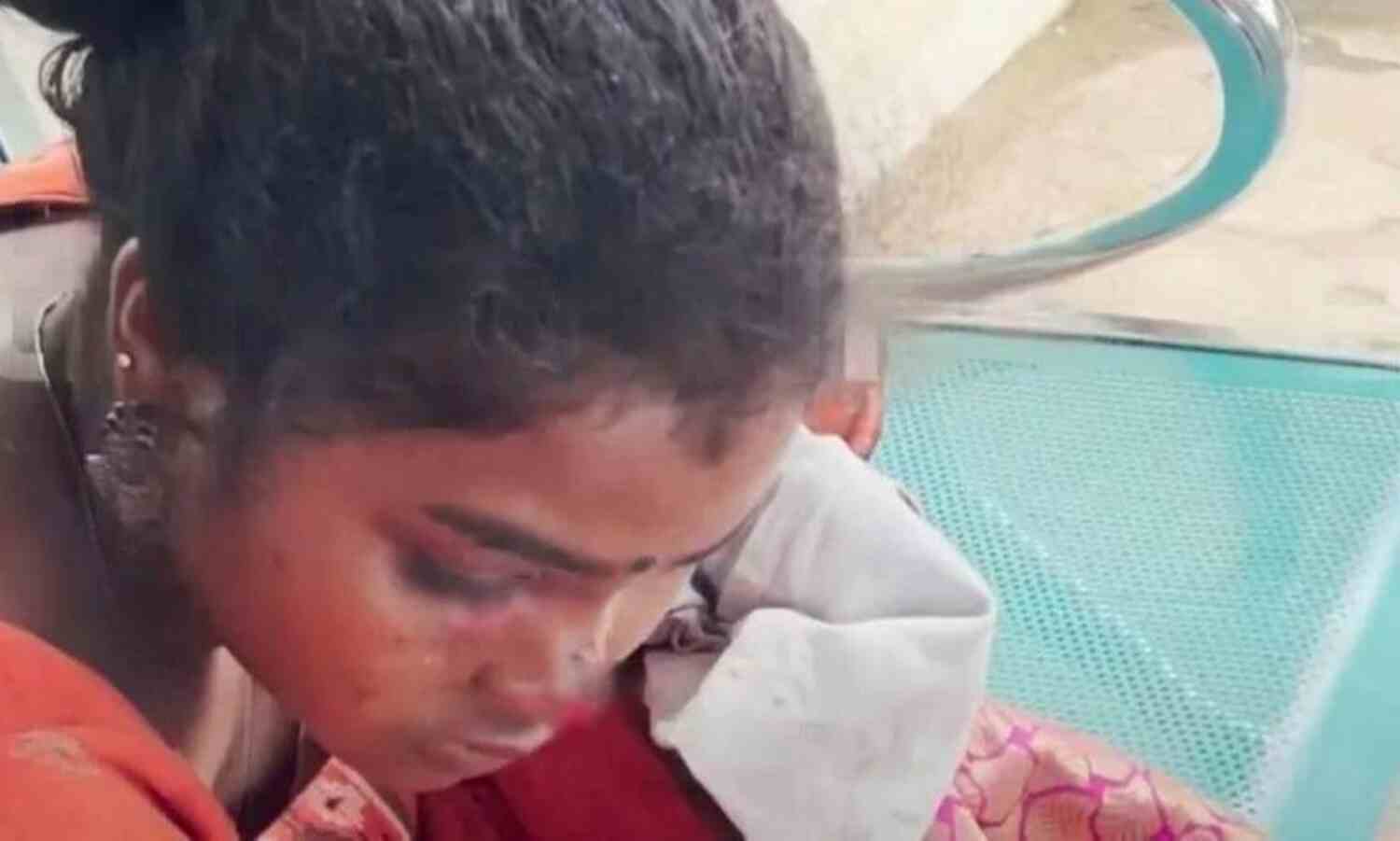വയനാട്ടില് വിദ്യാര്ഥിനിക്ക് നേരെ തെരുവുനായയുടെ ആക്രമണം; മുഖത്തും തുടയിലും കടിയേറ്റു വയനാട്ടില് വിദ്യാര്ഥിനിക്ക് നേരെ തെരുവുനായയുടെ ആക്രമണം; മുഖത്തും തുടയിലും കടിയേറ്റു