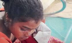 വയനാട്ടില്‍ വിദ്യാര്‍ഥിനിക്ക് നേരെ തെരുവുനായയുടെ ആക്രമണം; മുഖത്തും തുടയിലും കടിയേറ്റു