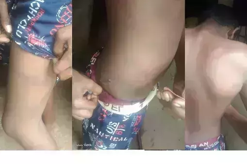 തിരുവനന്തപുരം ശ്രീചിത്ര പുവര്‍ ഹോമില്‍ 14കാരന് ക്രൂരമര്‍ദ്ദനം; തല്ലിയത് അഞ്ചു സഹപാഠികള്‍