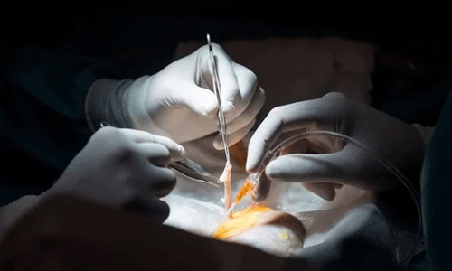 പാലക്കാട് ജില്ലാ ആശുപത്രിയില്‍ ചികില്‍സാപ്പിഴവ്;  ഒമ്പതുവയസ്സുകാരിയുടെ കൈ മുറിച്ചുമാറ്റേണ്ടി വന്നു