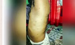 เดชเตเดจเตเดจเดพเดฎเดฒเดฏเดฟเตฝ เดชเตเดจเดฟเดจเตโเดฑเต เดเดเตเดฐเดฎเดฃเด; เดเดฑเต เดเตเดเตเดเดฌเดเตเดเตพ เดจเดฟเดฐเตเดเตเดทเดฃเดคเตเดคเดฟเตฝ เดชเตเดจเตเดจเดพเดฎเดฒเดฏเดฟเตฝ เดชเตเดจเดฟเดจเตโเดฑเต เดเดเตเดฐเดฎเดฃเด; เดเดฑเต เดเตเดเตเดเดฌเดเตเดเตพ เดจเดฟเดฐเตเดเตเดทเดฃเดคเตเดคเดฟเตฝ