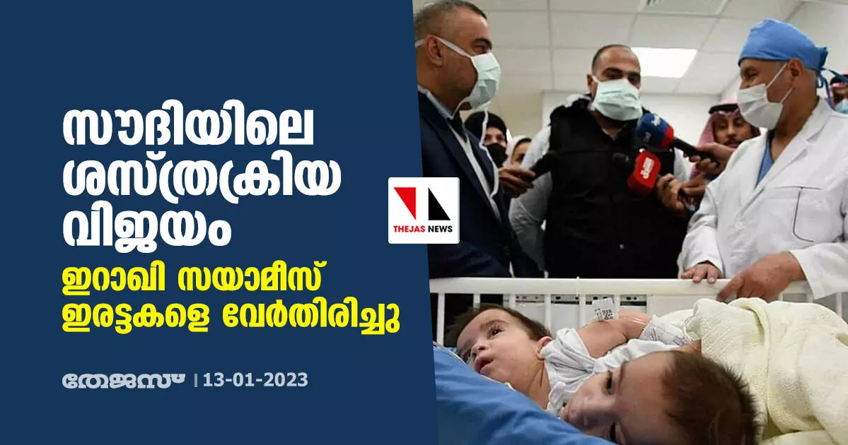സൗദിയിലെ ശസ്ത്രക്രിയ വിജയം; ഇറാഖി സയാമീസ് ഇരട്ടകളെ വേര്തിരിച്ചു സൗദിയിലെ ശസ്ത്രക്രിയ വിജയം; ഇറാഖി സയാമീസ് ഇരട്ടകളെ വേര്തിരിച്ചു