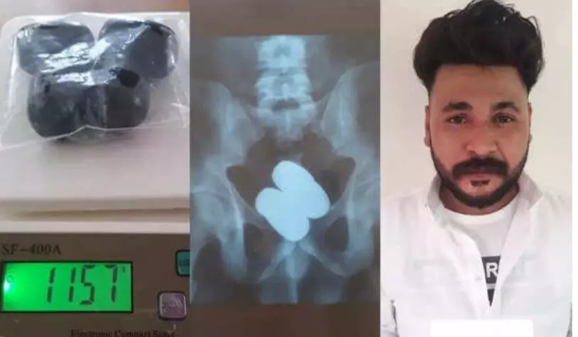 കരിപ്പൂരിൽ ശരീരത്തിൽ ഒളിപ്പിച്ച് സ്വർണം കടത്താൻ ശ്രമിച്ച വടകര സ്വദേശി പിടിയിൽ